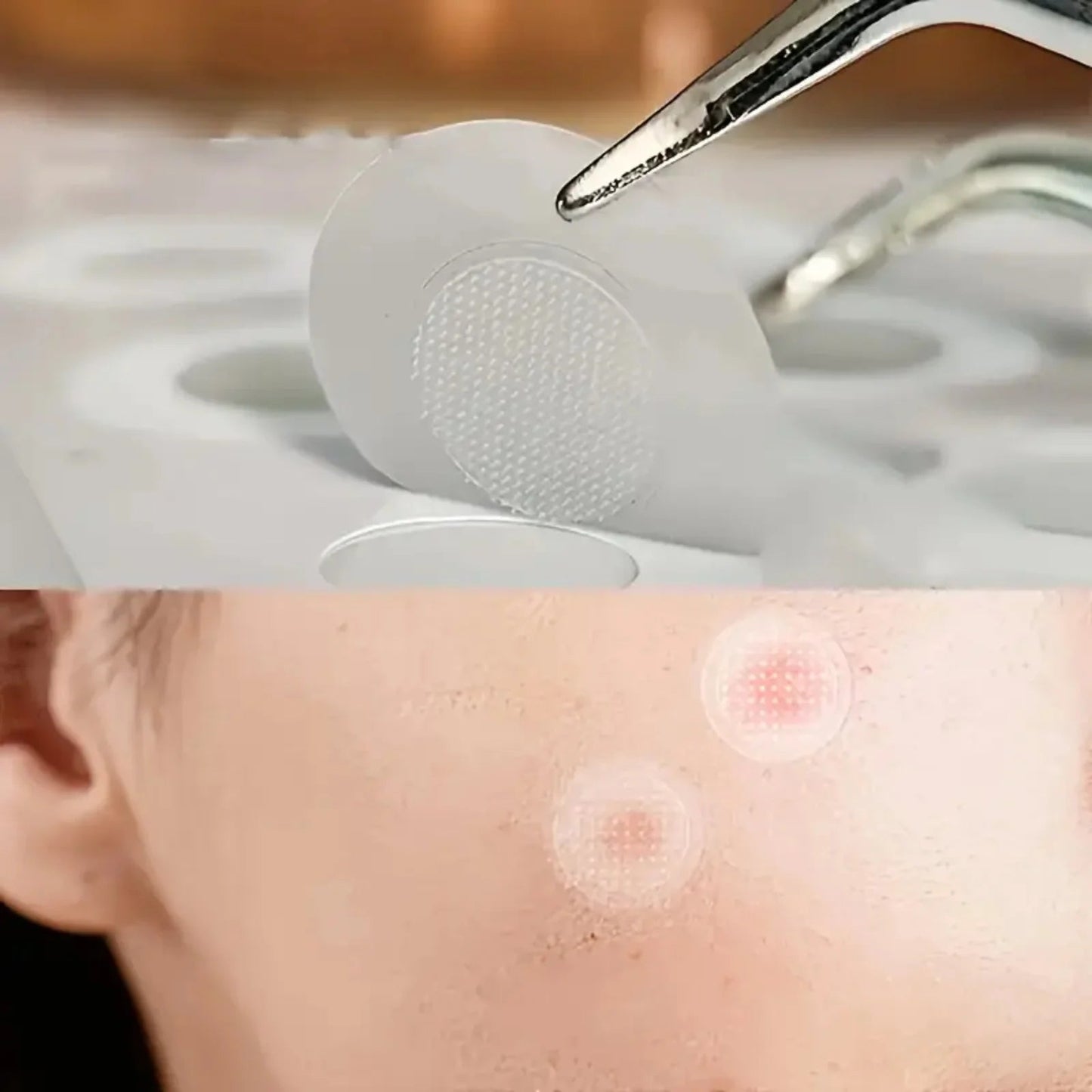 24pcsHydrocolloid Acne Stickers Daily Skincare Spot Covers Gentle Non-Drying, Individually Packaged, Waterproof & Oil-Absorbing - Spotlights shopping