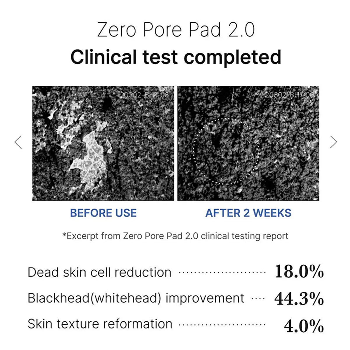 Medicube ZERO PORE PAD 2.0,Pre-Soaked Dual-Texture Cotton,Moisturizing & Calming Formula,Korean Skincare,K-Beauty,Korean Makeup - Spotlights shopping
