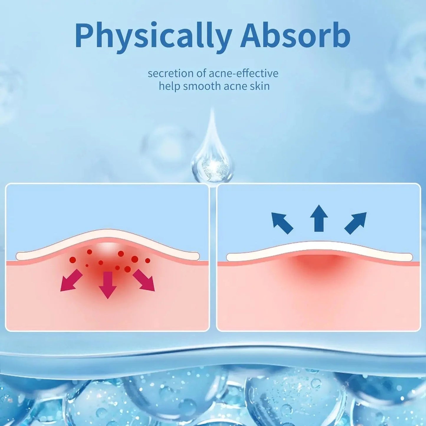24pcsHydrocolloid Acne Stickers Daily Skincare Spot Covers Gentle Non-Drying, Individually Packaged, Waterproof & Oil-Absorbing - Spotlights shopping