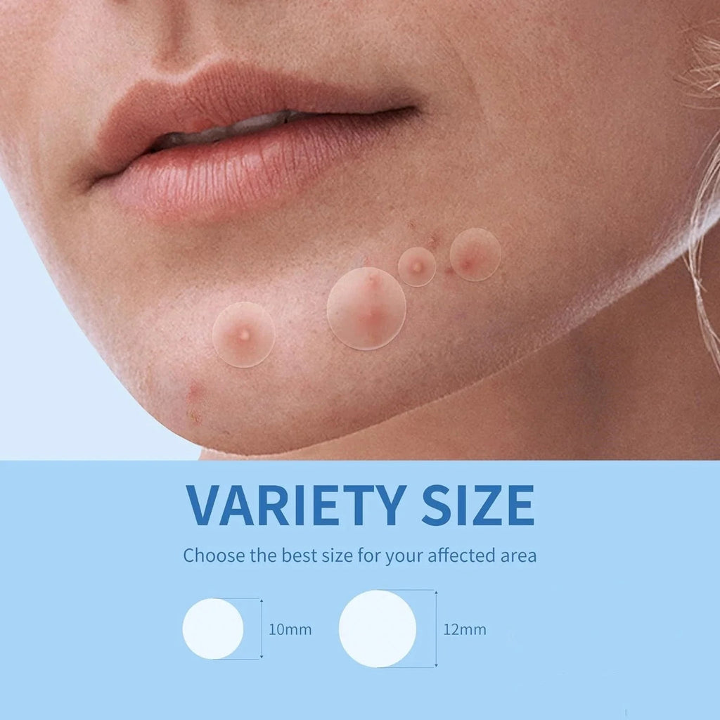 Acne Patches 360 Stuks – Onzichtbare Pimple Patches - Spotlights shopping