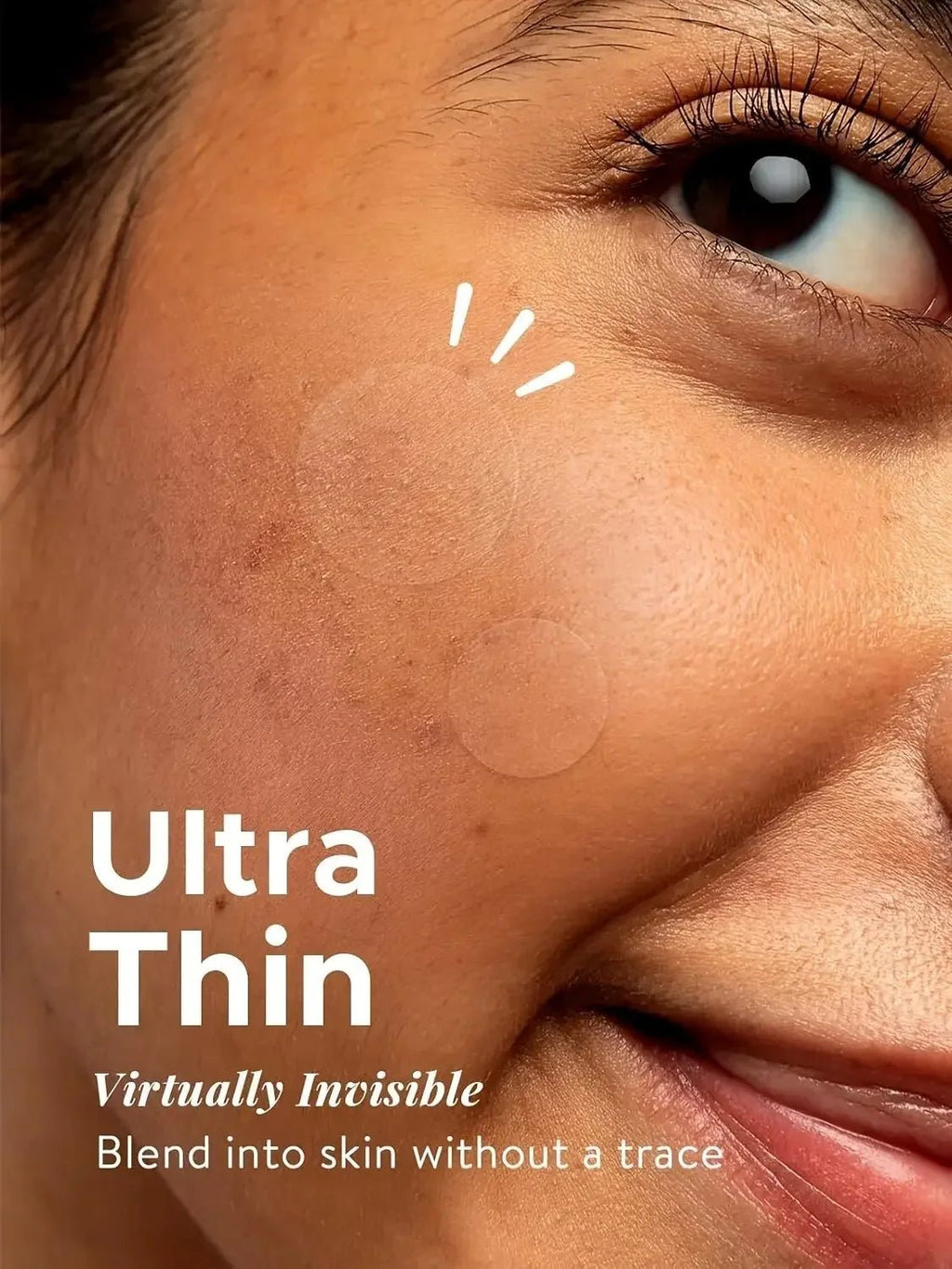 Acne Patches 360 Stuks – Onzichtbare Pimple Patches - Spotlights shopping