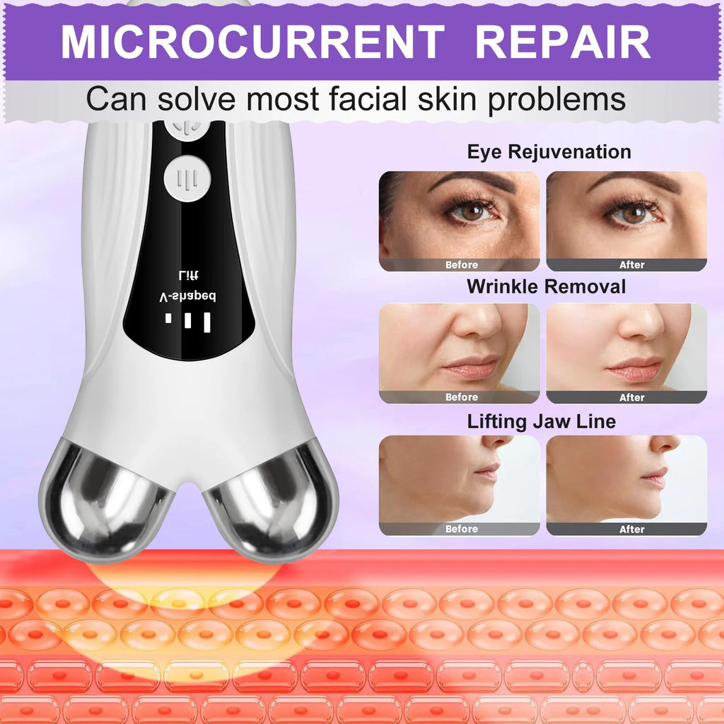 CMH EMS Gezichtsmassage Apparaat – V-Face Roller met Microcurrent & Warmte - Spotlights shopping