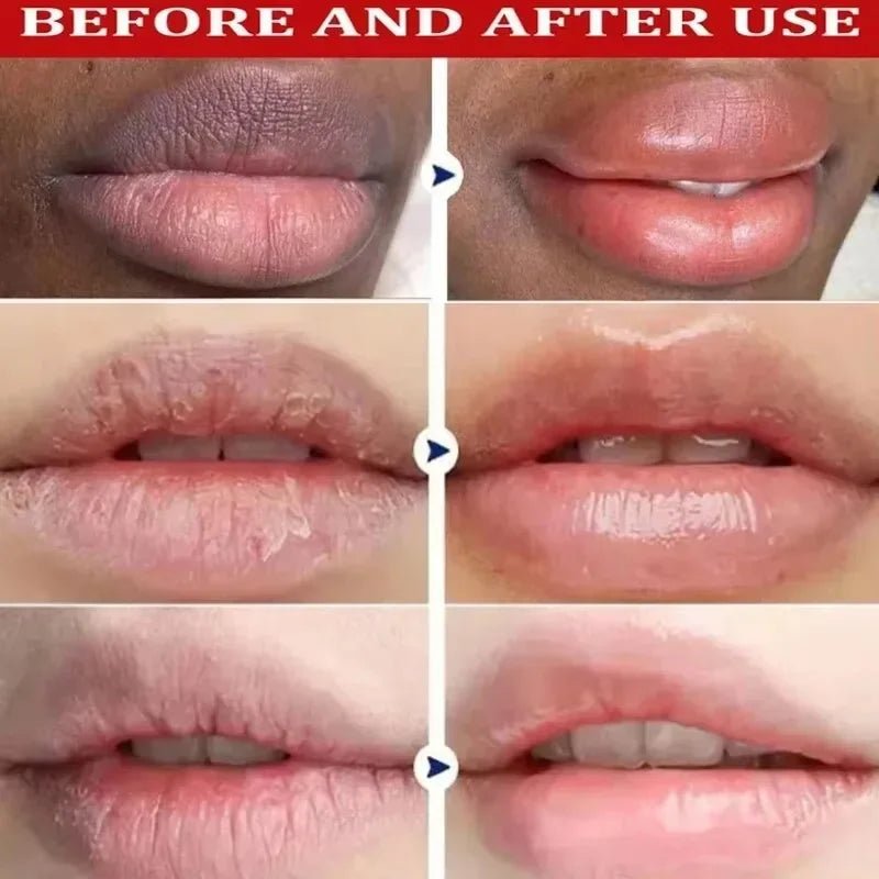 Fast Remove Dark Lip Balm Serum Lighten Melanin Lip Mask Exfoliating Fade Lip Lines Dead Skin Nourishing Repair Lip Care Makeup - Spotlights shopping