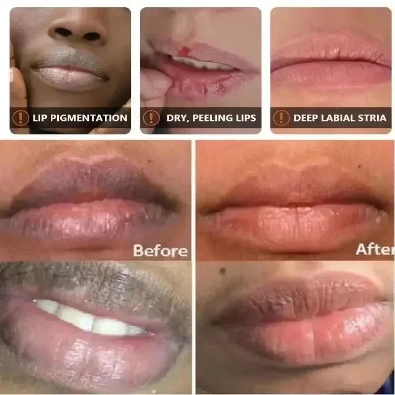 Fast Remove Dark Lip Balm Serum Lighten Melanin Lip Mask Exfoliating Fade Lip Lines Dead Skin Nourishing Repair Lip Care Makeup - Spotlights shopping