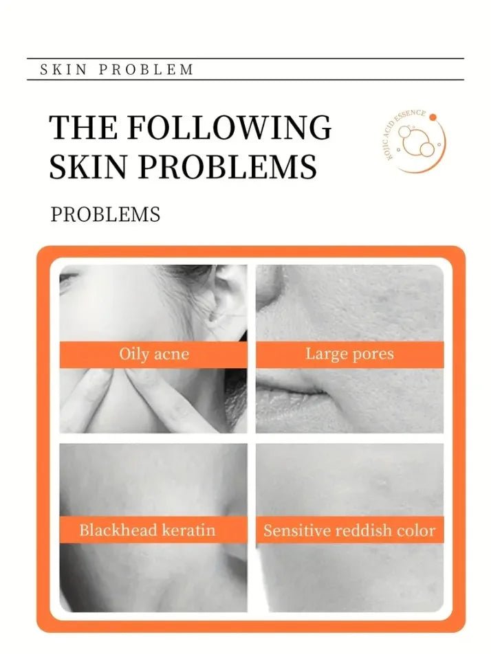 Kojic Acid Brightening Soap met kurkuma, retinol en vitaminen voor dagelijkse huidverzorging