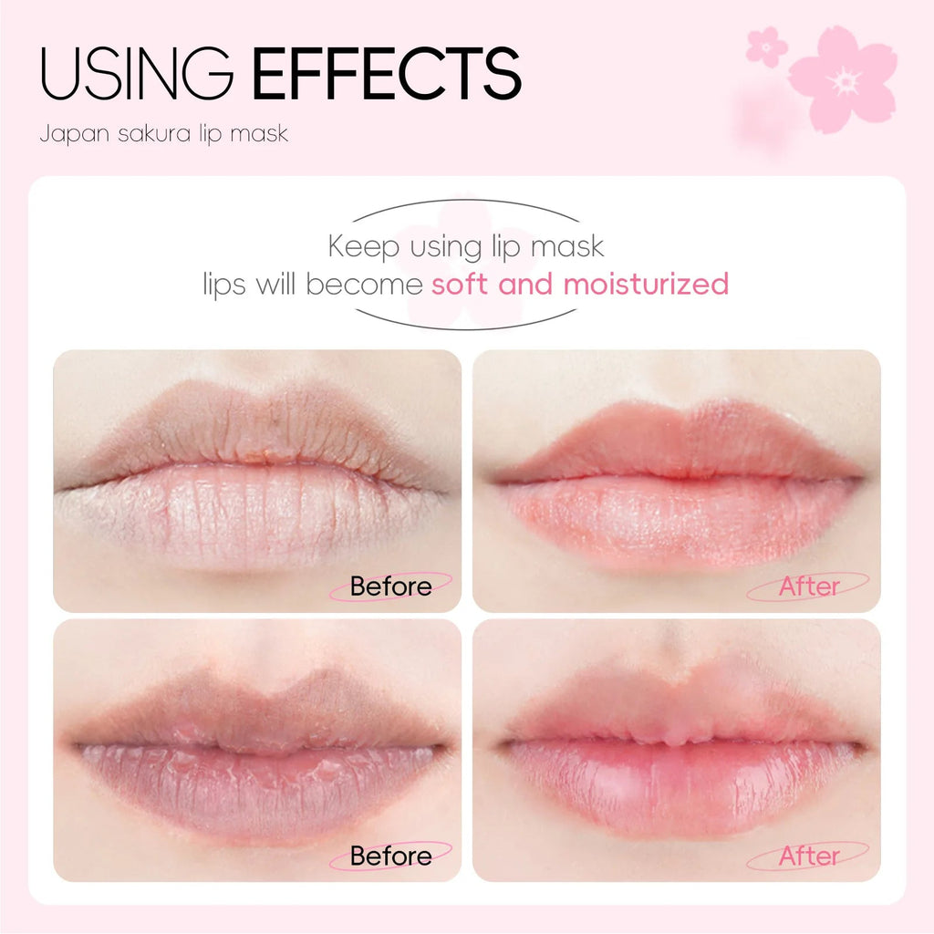 LAIKOU hydrogel lipmaskers voor hydraterende en verzorgende lipverzorging