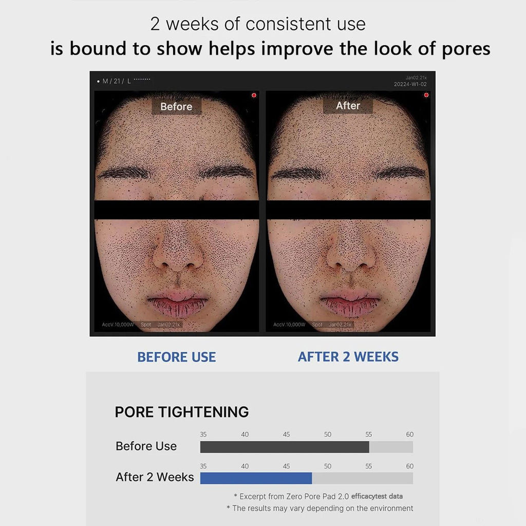 Medicube Zero Pore Pad 2.0 dubbelzijdige Koreaanse skincare pads