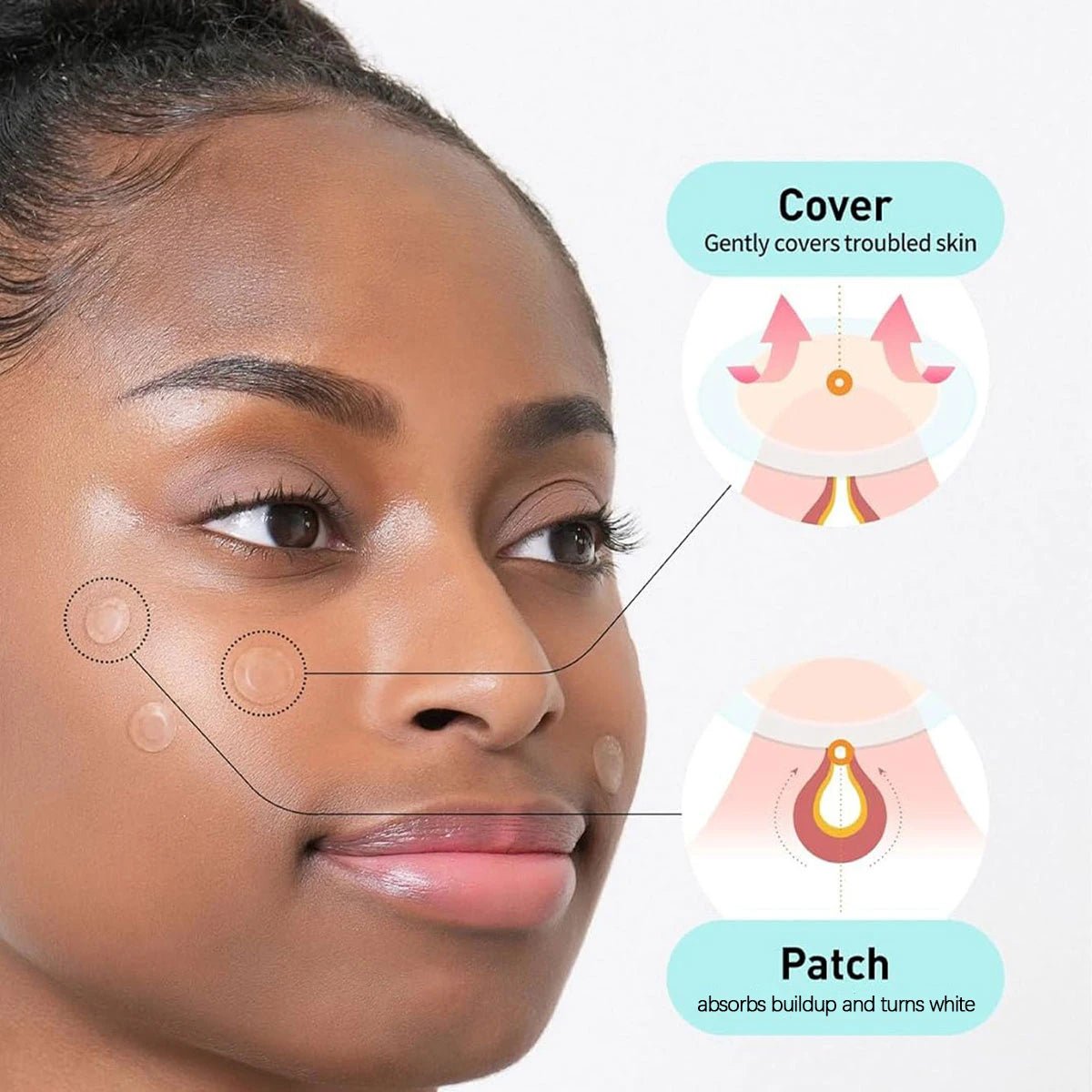 Olive Young Care Plus Spot Cover Spot Patch,Hydrogel Texture,Skin-Conforming,Blemish Skin,Korean Skincare,K-Beauty,Korean Makeup - Spotlights shopping