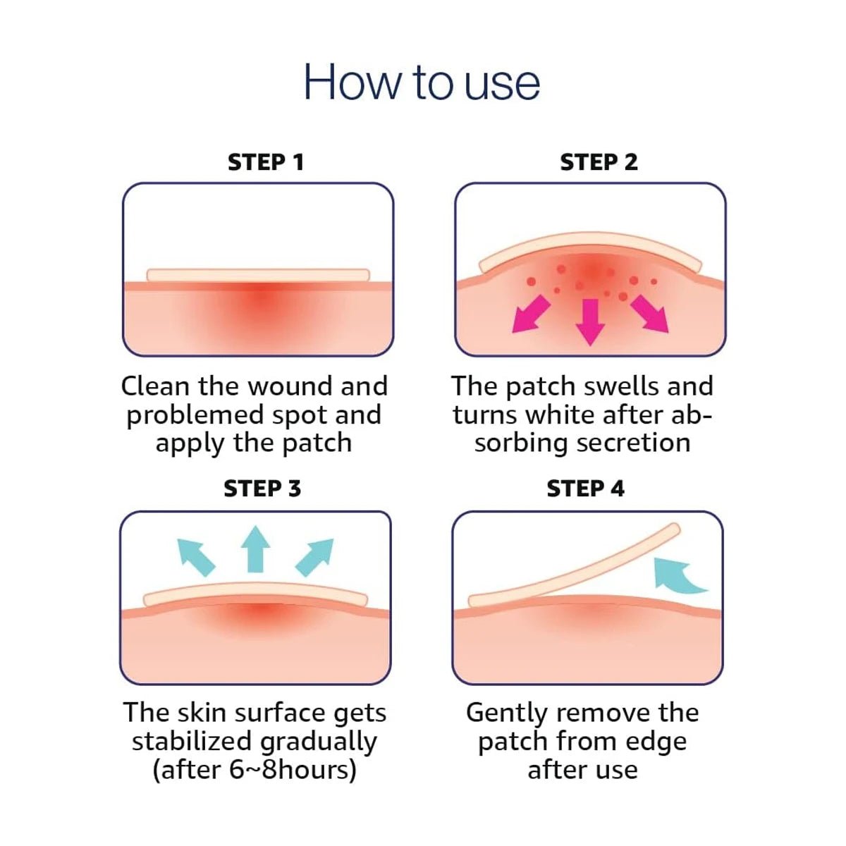 Olive Young Care Plus Spot Cover Spot Patch,Hydrogel Texture,Skin-Conforming,Blemish Skin,Korean Skincare,K-Beauty,Korean Makeup - Spotlights shopping