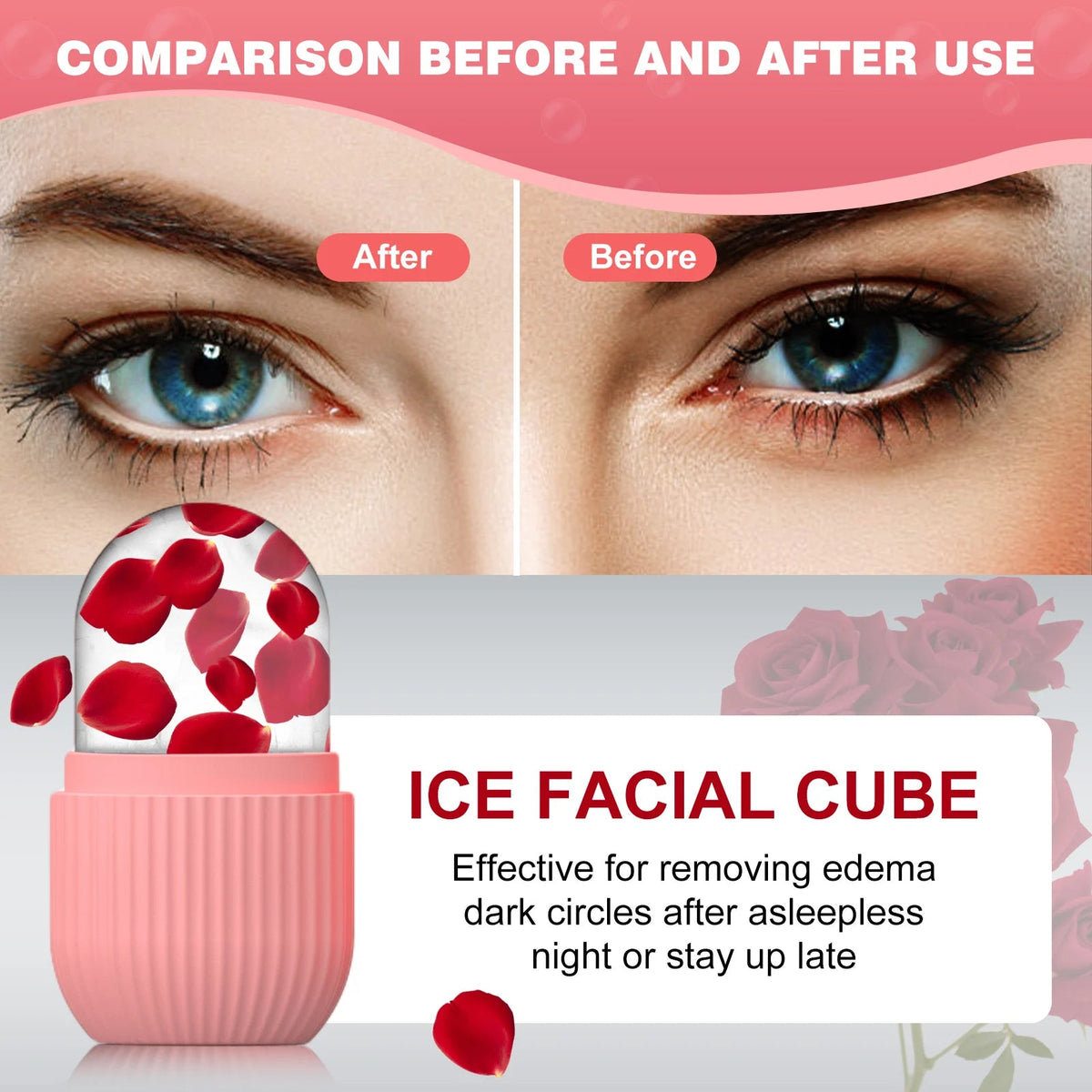 Siliconen IJsroller voor Gezicht – Ice Cube Skincare Tool - Spotlights shopping