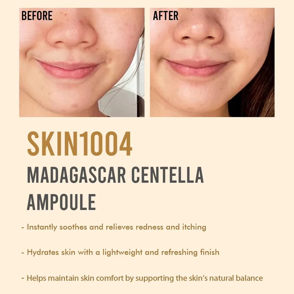 SKIN1004 Madagascar Centella Ampoule | Kalmerend Gezichtsserum voor Gevoelige Huid | 55 ml